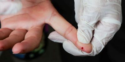 SUS passa a oferecer teste rápido de dengue