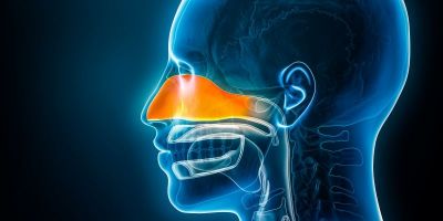 Sinusite odontogênica - entenda os sintomas e os impactos na saúde