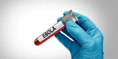 Governo gaúcho divulga nota técnica com orientações sobre manejo de casos suspeitos de contaminação pelo vírus Ebola