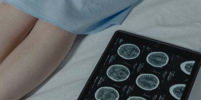 Sinais de alerta do AVC: como reconhecer os sintomas e agir com rapidez
