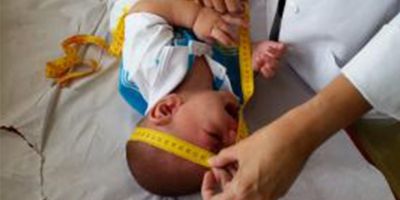 1.384 bebês nasceram com microcefalia entre outubro e maio, diz Ministério da Saúde