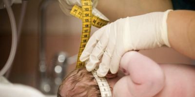 Vírus bovino é encontrado em tecidos de bebês com microcefalia