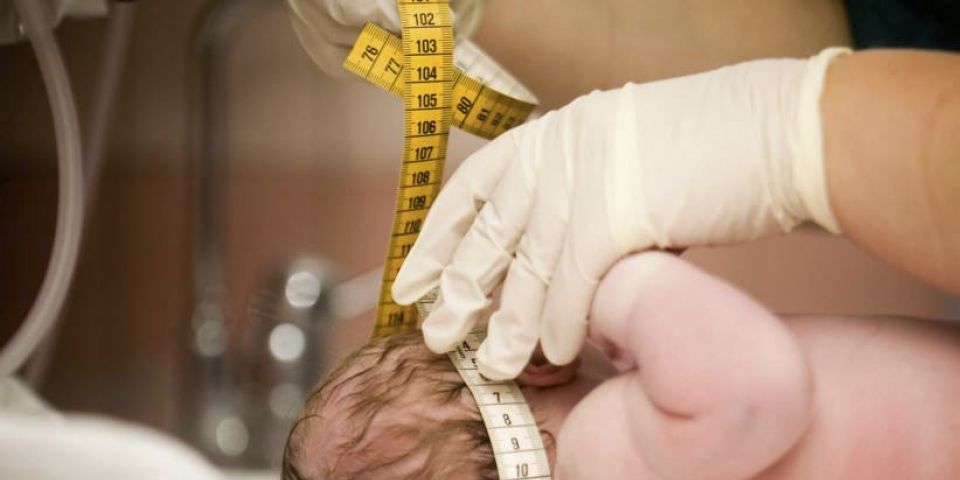 Vírus bovino é encontrado em tecidos de bebês com microcefalia