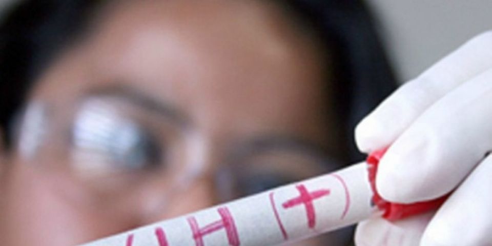 Novas infecções por HIV em adultos voltam a aumentar em algumas regiões do mundo