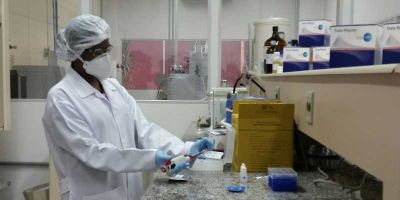 Ministério da Saúde vai distribuir 3,5 milhões de testes rápidos de zika