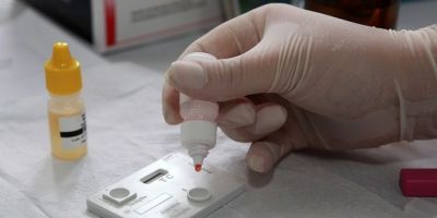 Casos de sífilis voltam a aumentar no Brasil