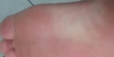 Motoboy é mordido por cachorro na tarde deste domingo no centro de Camaquã