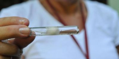 Saúde confirma primeiro caso de microcefalia associado ao zika contraído no RS