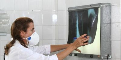 Brasil se aproxima de padrão positivo de combate à tuberculose, mostra relatório