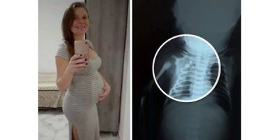 Morre no Rio bebê que foi baleado quando ainda estava na barriga da mãe