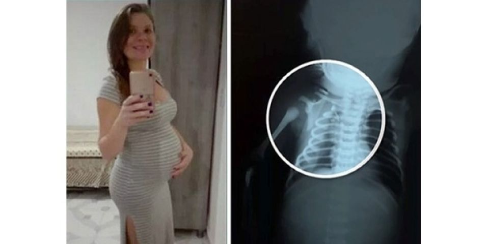 Morre no Rio bebê que foi baleado quando ainda estava na barriga da mãe