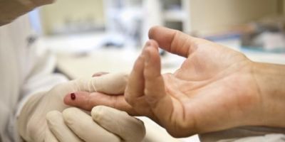 Remédio que previne contaminação pelo vírus HIV será oferecido pelo SUS este mês