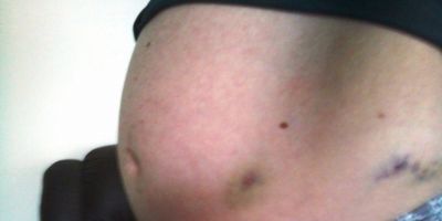 Muito obrigado! A jovem grávida de 6 meses já possui todo o medicamento