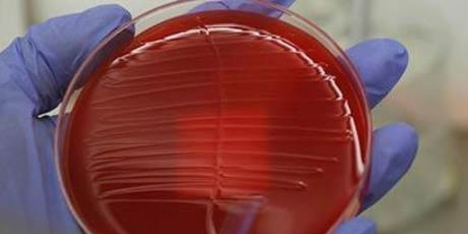 Meningite transmitida por parasitas se espalha pelo Brasil
