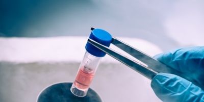 Cientistas dos EUA avançam no uso células-tronco para doenças incuráveis
