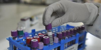 Protozoário da toxoplasmose é encontrado em caixa d'água de Santa Maria