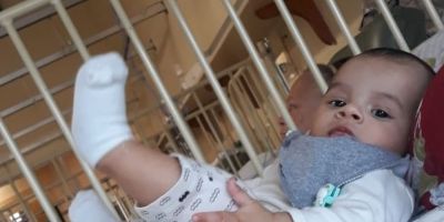 Cirurgiões de seis estados do país operam bebê com malformação rara em Porto Alegre