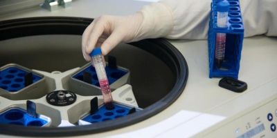 Vacina contra HIV será testada em humanos até o fim do ano