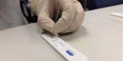 Camaquã recebe 500 testes rápidos para a testagem da covid-19 