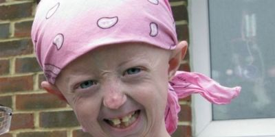 'Adolescente de 100 anos' morre aos 17 na Inglaterra