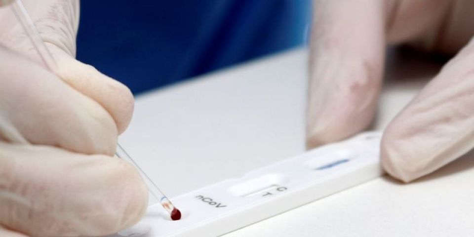 Covid-19: mortes somam mais de 226 mil e casos, 9,2 milhões