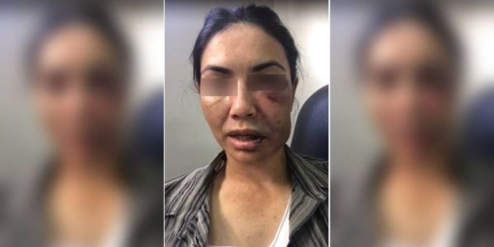Motorista de aplicativo é agredida e jogada de ponte durante assalto praticado por quatro adolescentes 