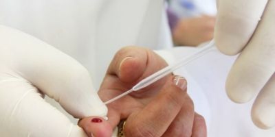 Cartilha incentiva retomada de ações de prevenção a IST/HIV e Hepatites Virais