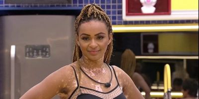 Tem cura? Natália Deotado, participante do Big Brother Brasil 22, tem vitiligo há mais de 12 anos 