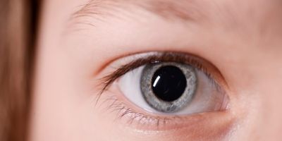 Retinoblastoma: câncer no olho de bebês pode ser detectado em fotos feitas com flash