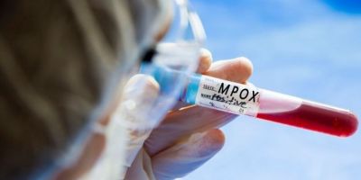 Brasil supera marca de mil casos de mpox em 2024