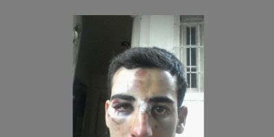 Ciclista cai em buraco e sofre vários ferimentos em Camaquã 