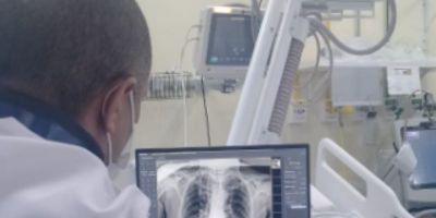 HNSA de Camaquã adquire novo equipamento de raio X