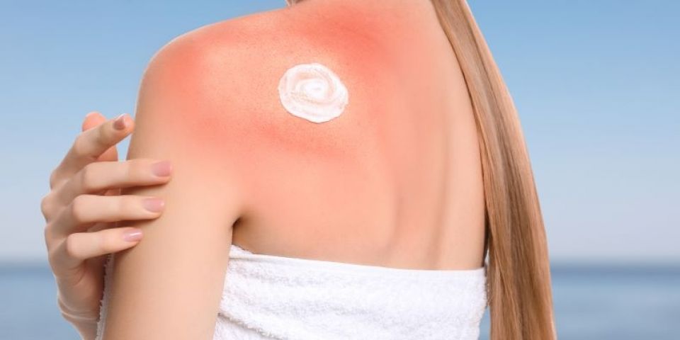Saúde da pele: como proteger o maior órgão do corpo humano dos efeitos ambientais