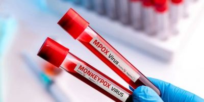 Saúde confirma primeiro caso de nova cepa de mpox no Brasil