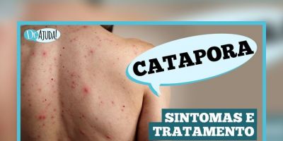 Catapora: sintomas, complicações e prevenção