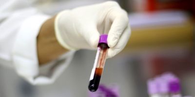 Exame descarta caso suspeito de gripe aviária em trabalhador de granja de Montenegro