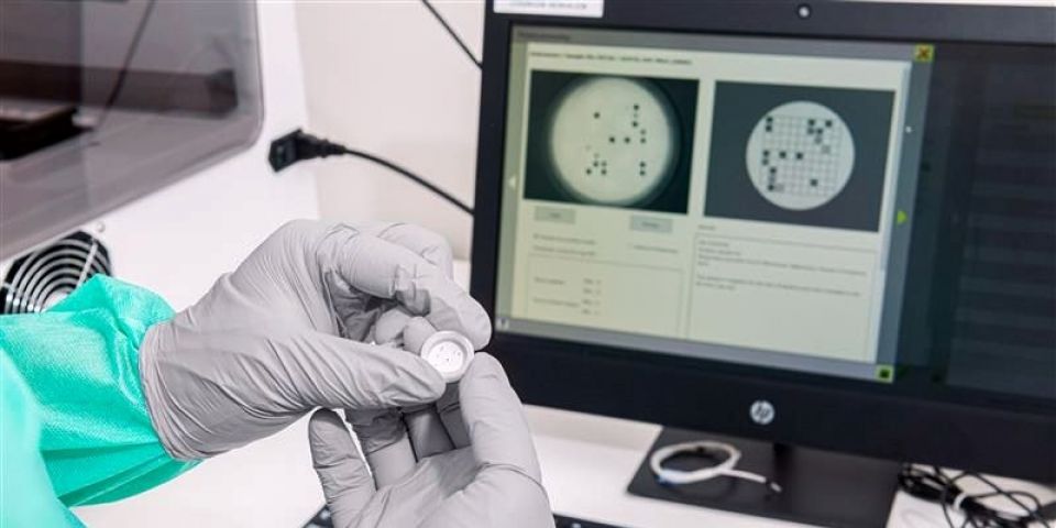 Papanicolau é substituído no SUS por teste que consegue detectar o HPV com até 10 anos de antecedência ao desenvolvimento de lesões