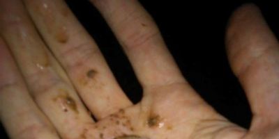 Interior de Chuvisca é atingido por granizo na última sexta