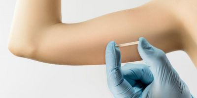 ANS determina que planos de saúde terão que oferecer implante contraceptivo hormonal