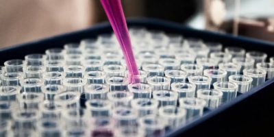 Pesquisas brasileiras avançam no diagnóstico de Alzheimer