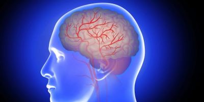 AVC mata uma pessoa a cada seis minutos no Brasil