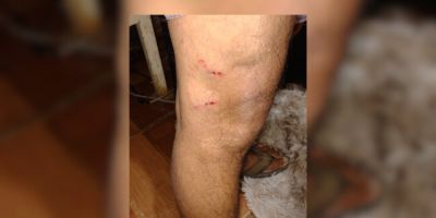 Cachorro ataca e morde homem no bairro Viégas em Camaquã