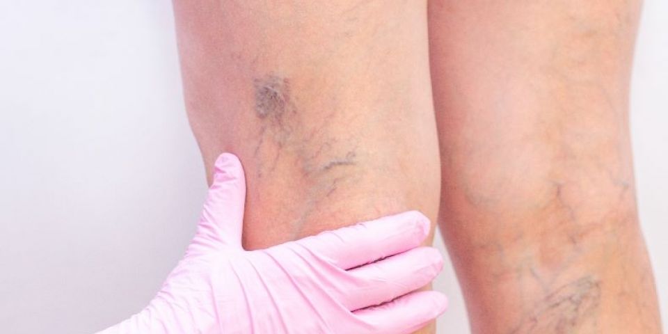 A ciência de envelhecer bem: saúde vascular e os cuidados que o tempo exige