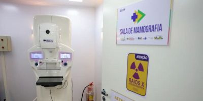 Lei garante mamografia pelo SUS para mulheres a partir dos 40 anos