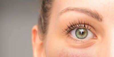 Mitos e verdades sobre rosácea