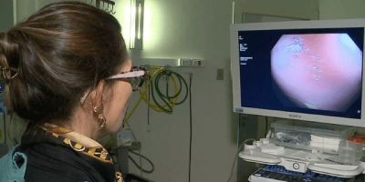 Brasil deve ter 781 mil novos casos de câncer por ano até 2028