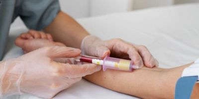 Câncer antes dos 50: entenda o papel da biópsia líquida em meio ao aumento de casos